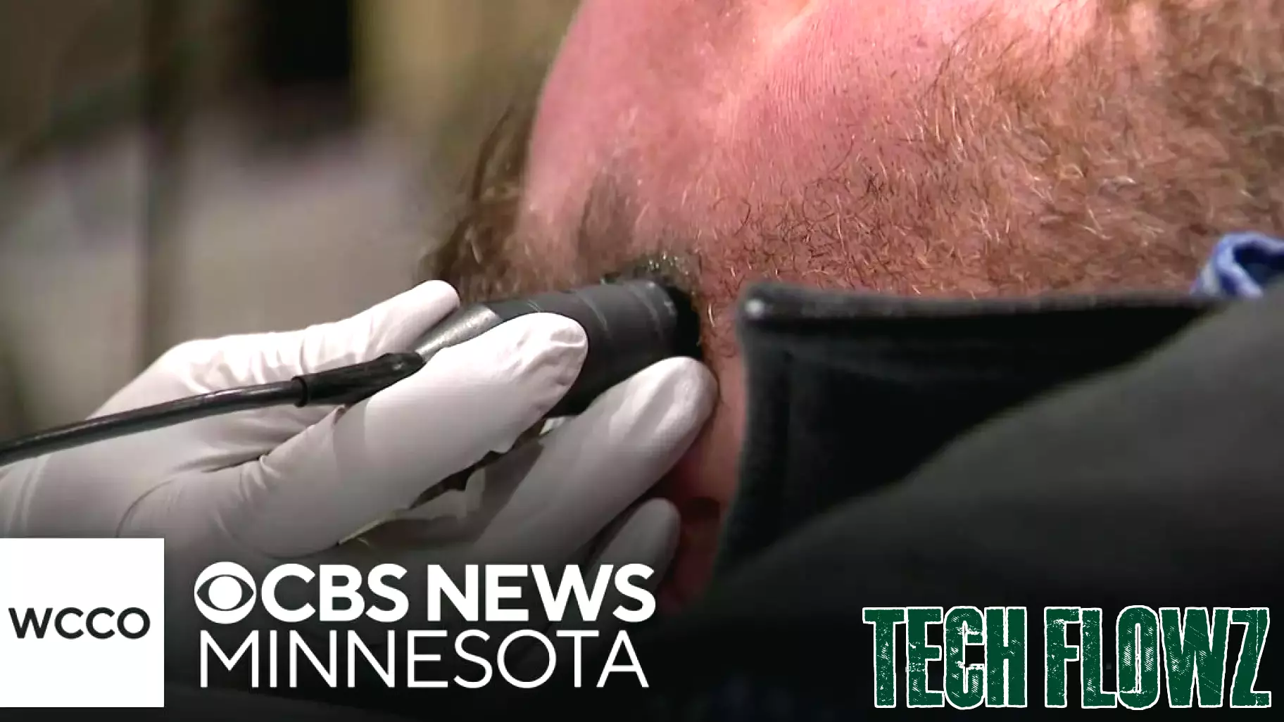 Innovative Technology Aims to Reduce Stroke Incidence